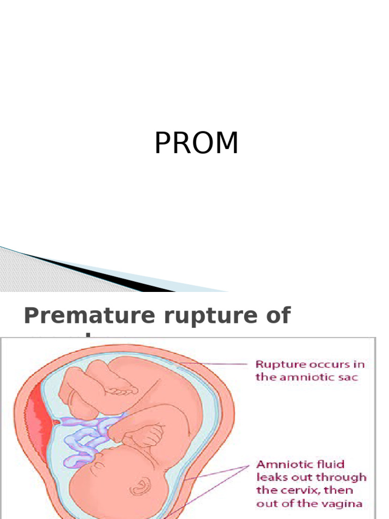 Prom Np-B-34-Ok | PDF