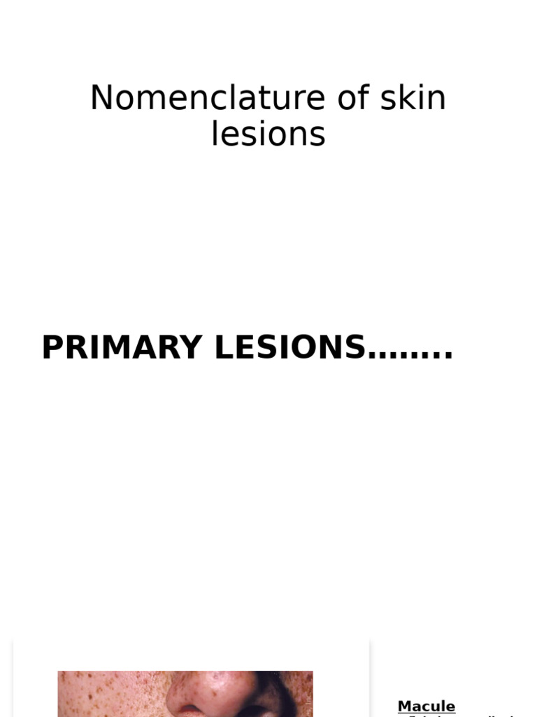Lesions (1) - 1 | PDF