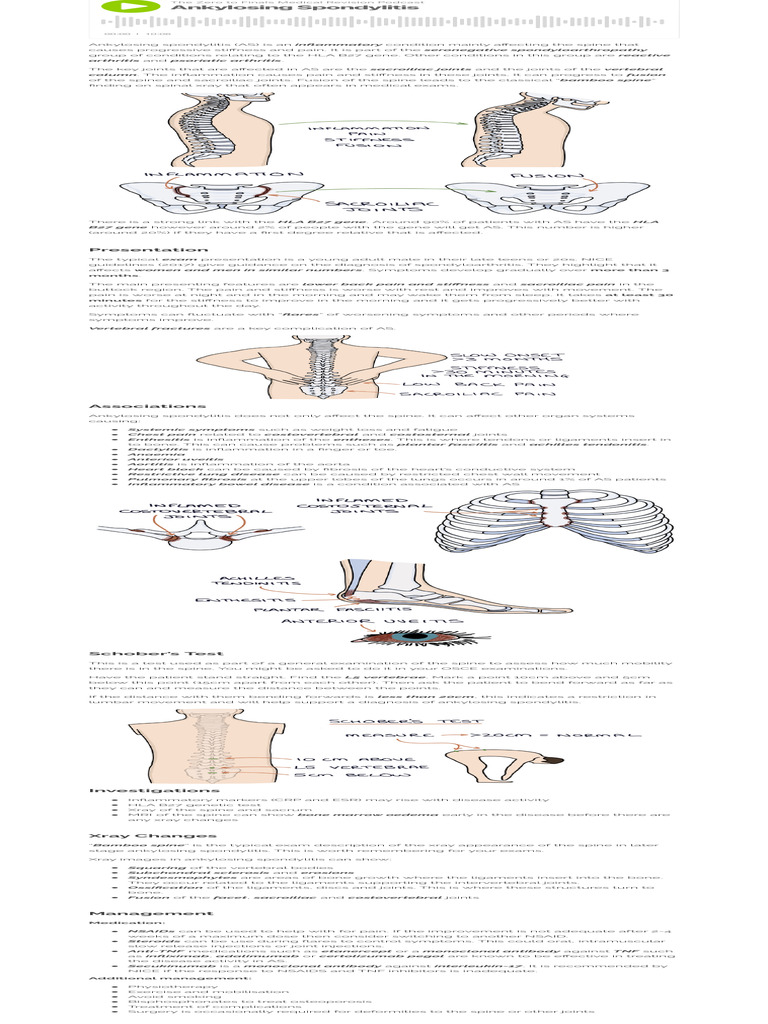 Ankylosing Spondylitis | PDF