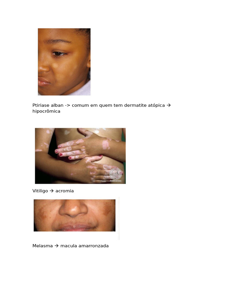 Aula De Lesões Elementares Pdf