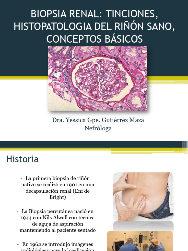Riñon Sano | PDF
