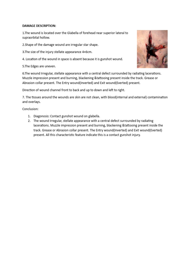 Forensic Description Gunshot Wound | PDF