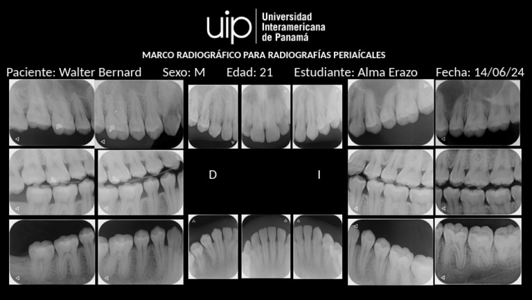 Marco Radiográfico Periapical Walter | PDF