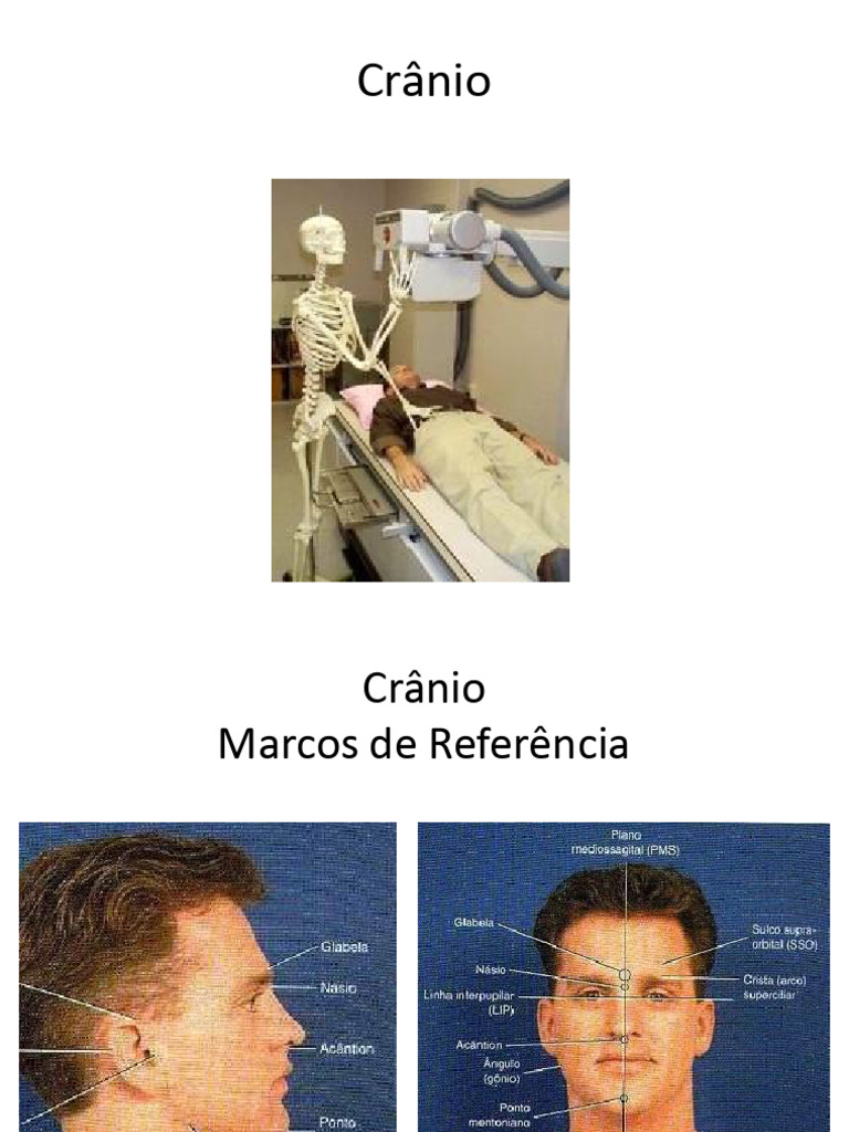 Crânio | PDF