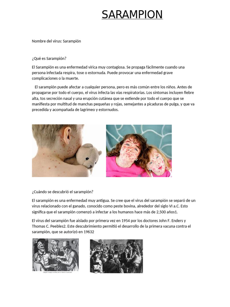 Sarampión Pdf