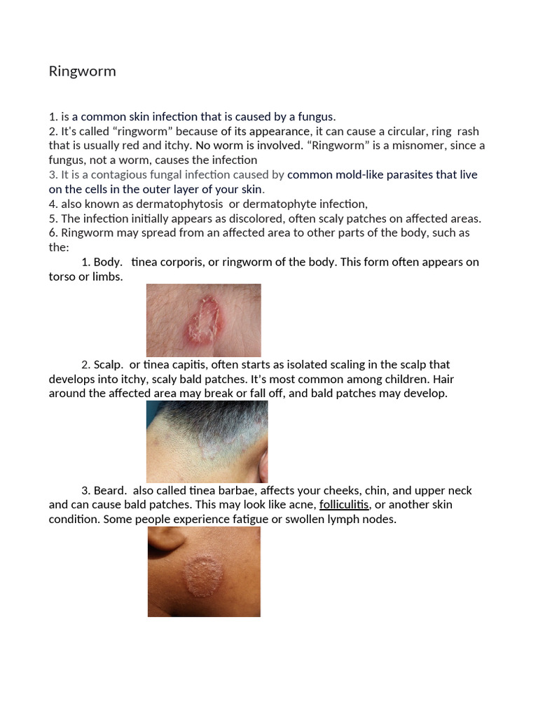 Ringworm | PDF