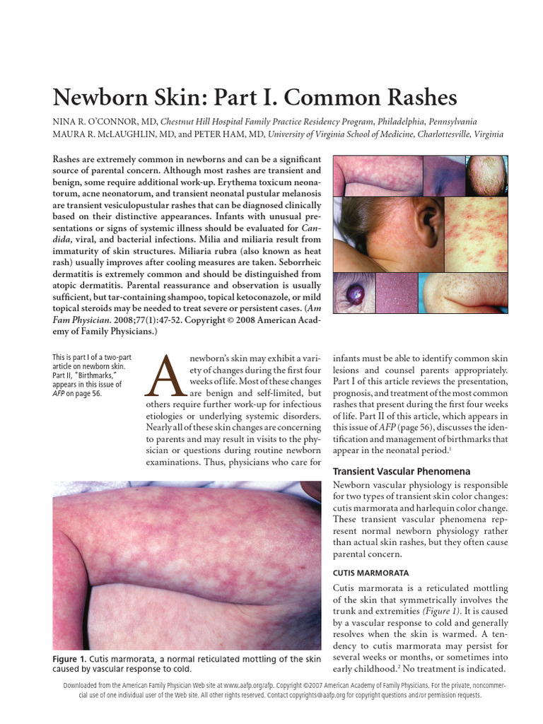 Newborn Skin Part I. Common R | PDF