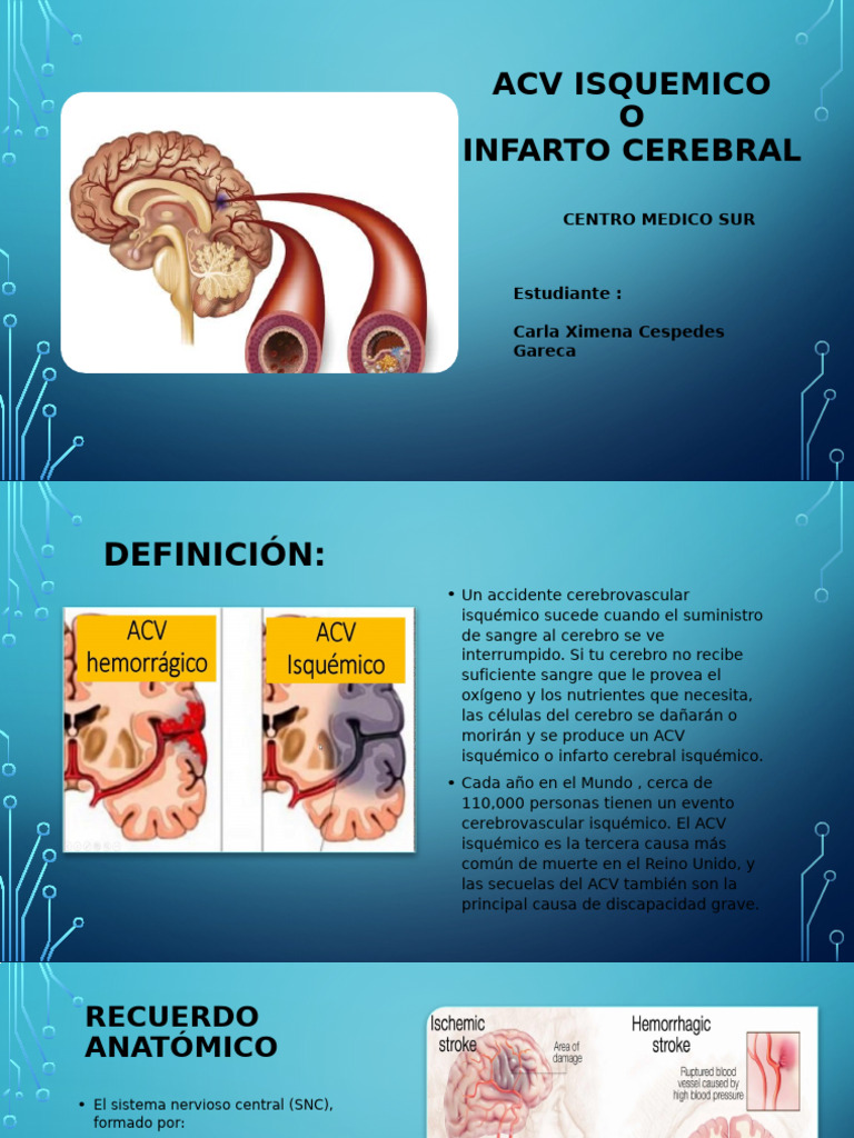 Acv Izquemico 18 | PDF