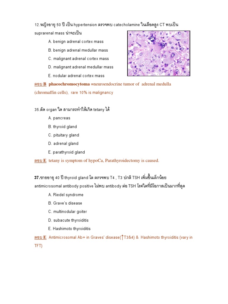 Adrenal Mass and Thyroid Disorders Overview | PDF | Adrenal Gland ...