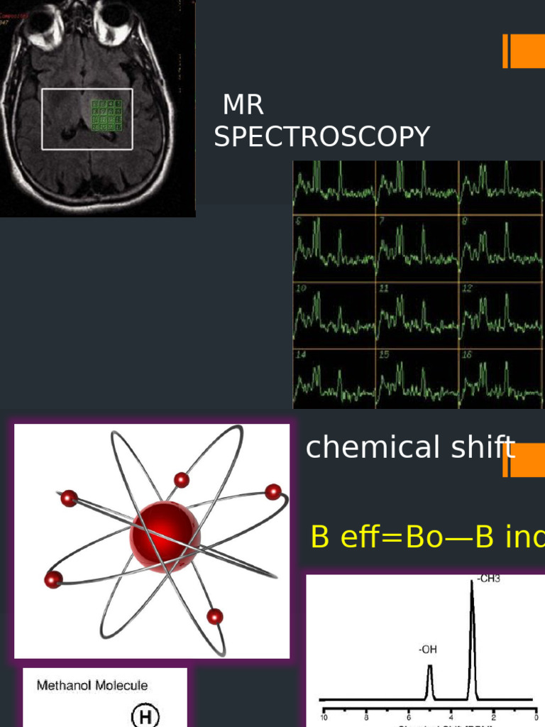 MR Spectroscopy: Neurochemical Analysis | PDF | Magnetic Resonance Imaging