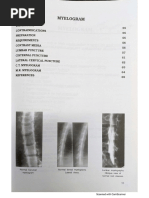 Helical VS Axial CT Scanning | PDF | Science & Mathematics | Computers