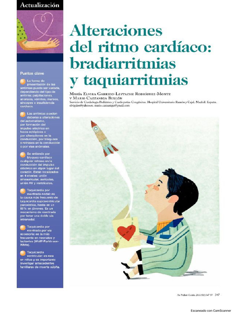 Alteraciones Del Ritmo Cardiaco | PDF