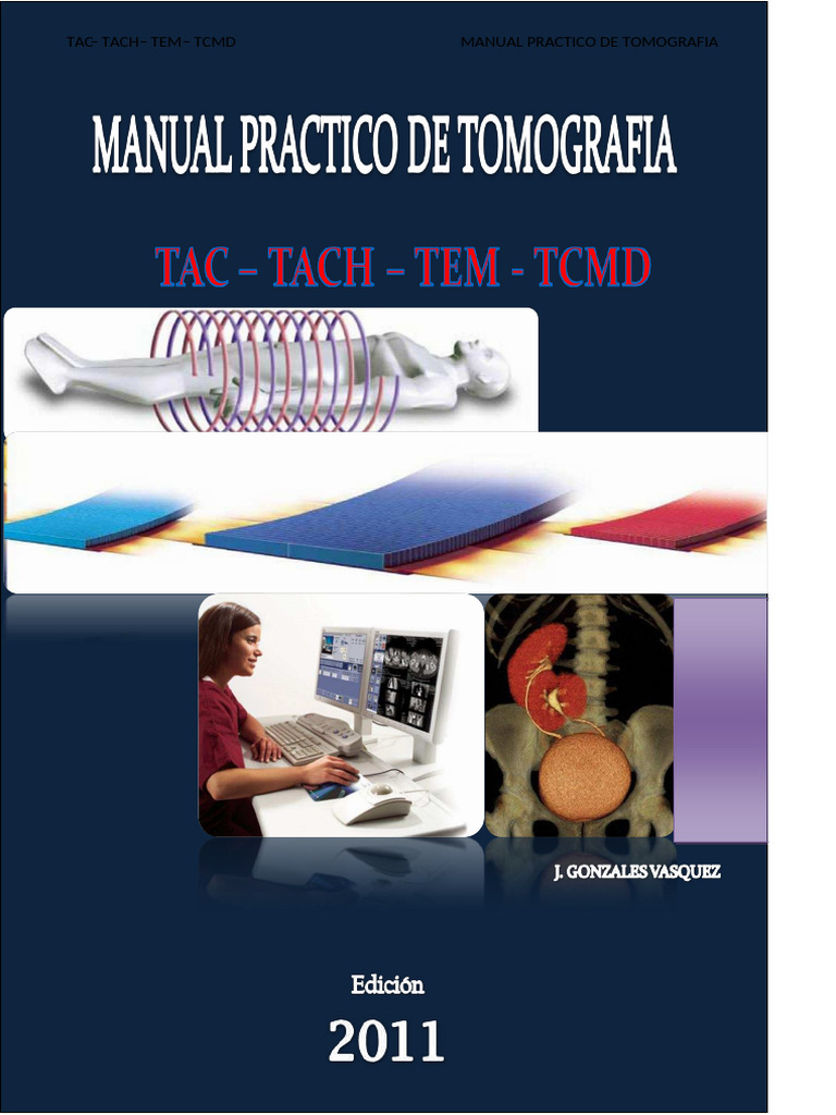 Manual Practico de Tomografia PDF | PDF