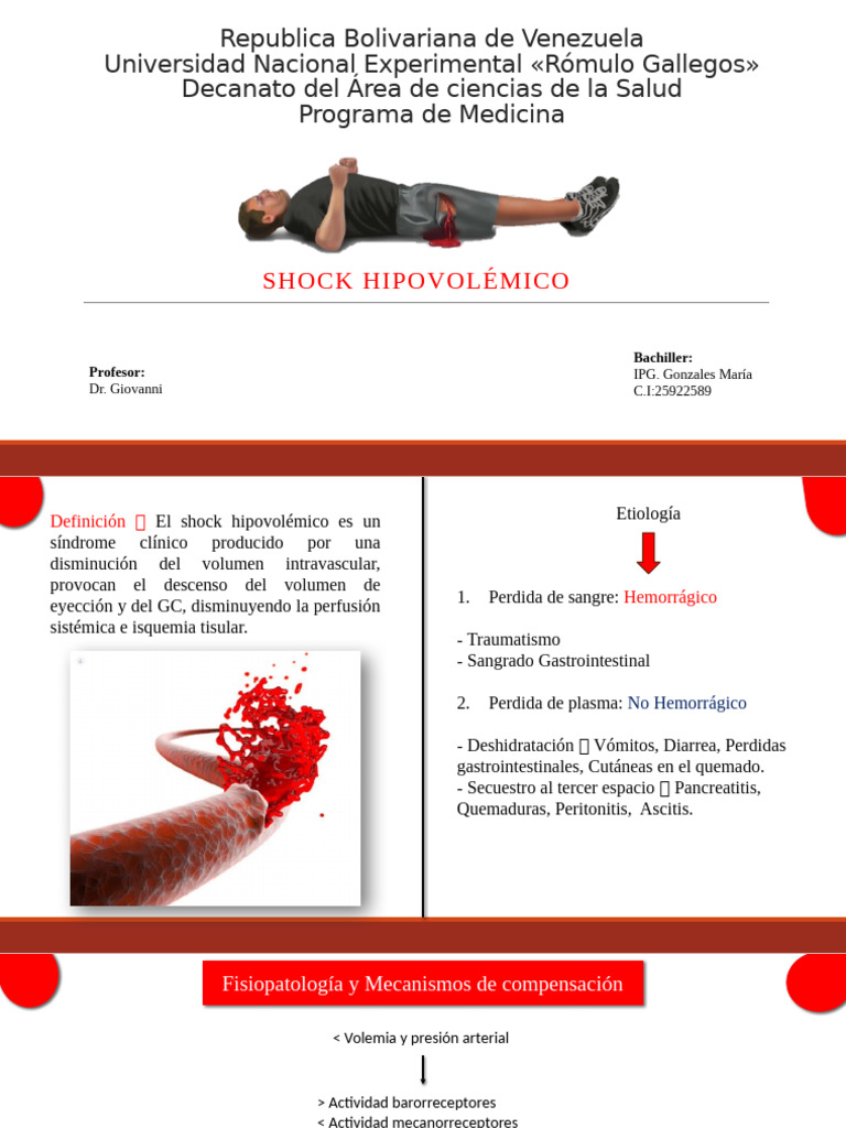 Shock Hipovolemico - Maria | PDF