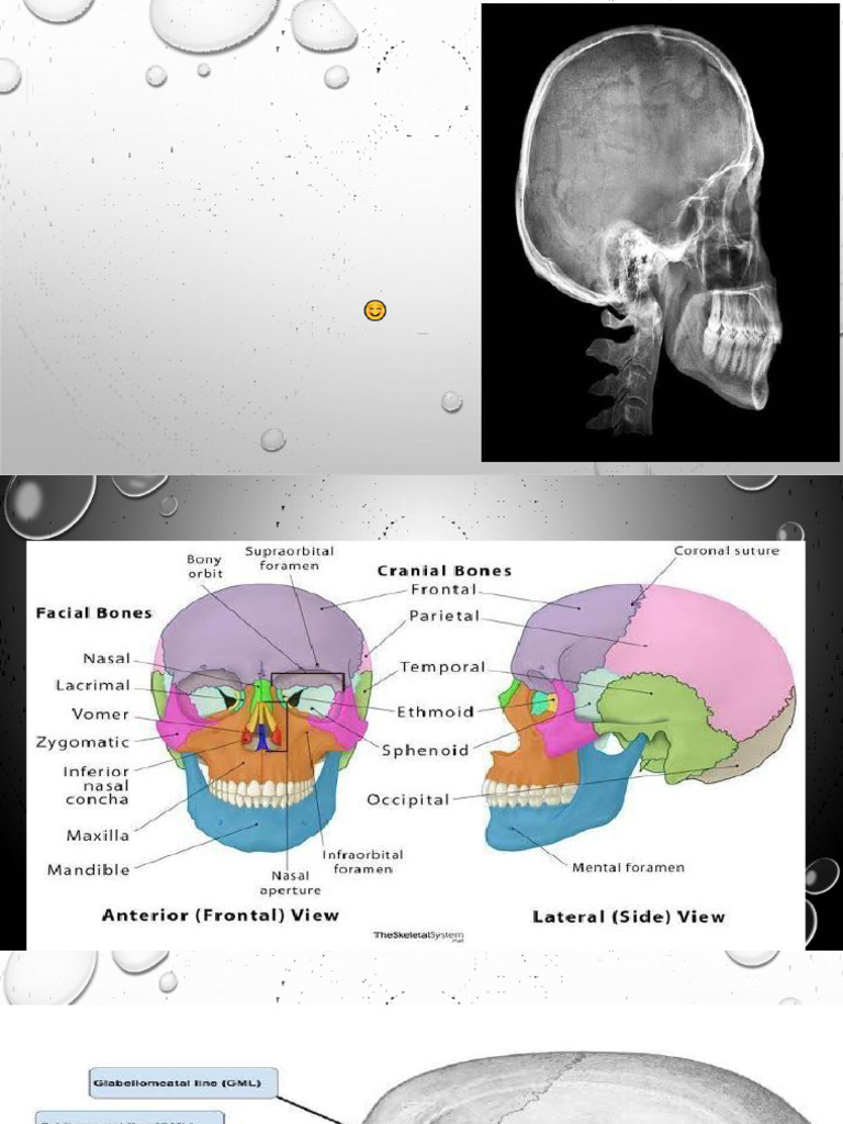 Skull Radiography | PDF