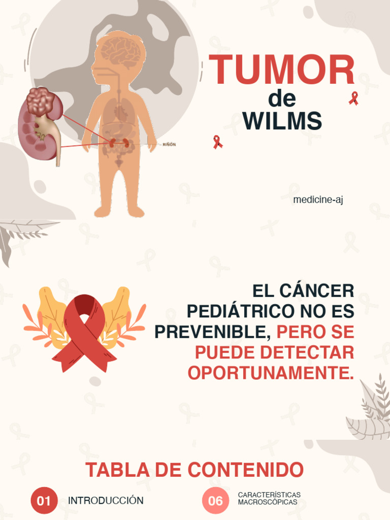Tumor de Wilms Medicine Aj | PDF
