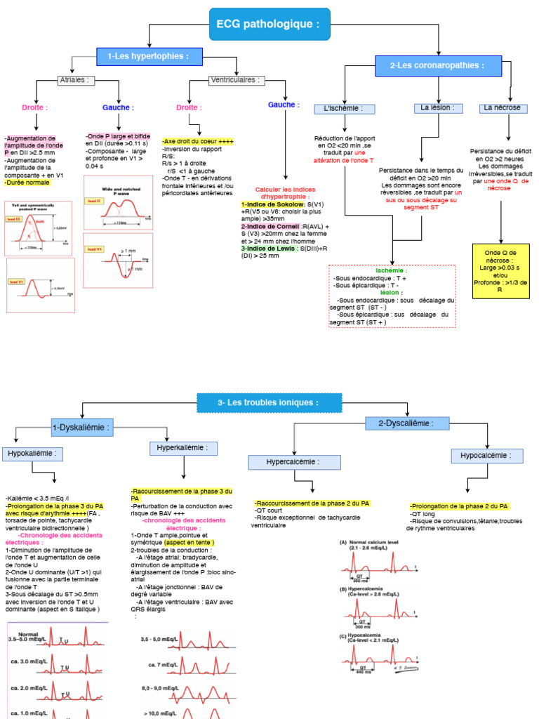 ECG Patholoique | PDF