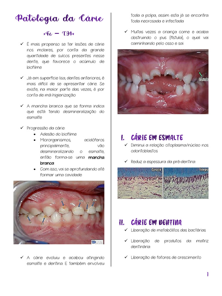 patologia-da-c-rie-pdf-dentina-esmalte-dent-rio