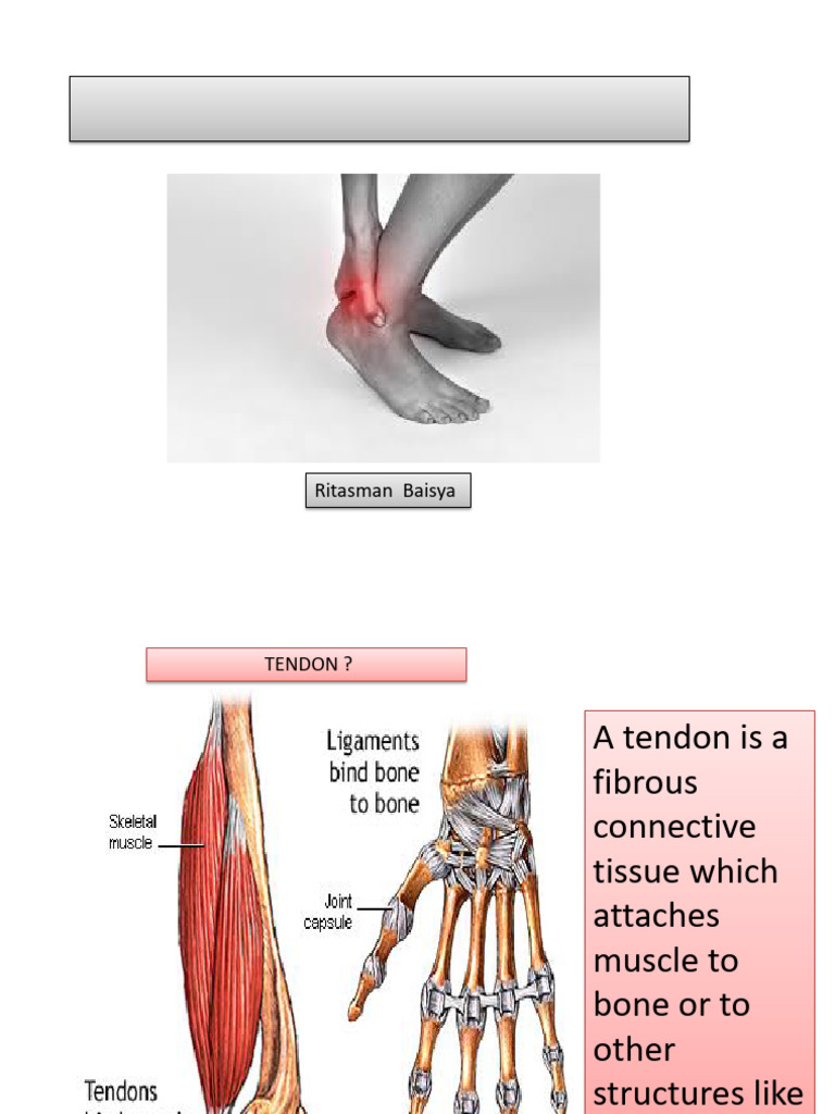 Presentationtendinopathy11 230708192310 1a416f0f | PDF | Extracellular ...