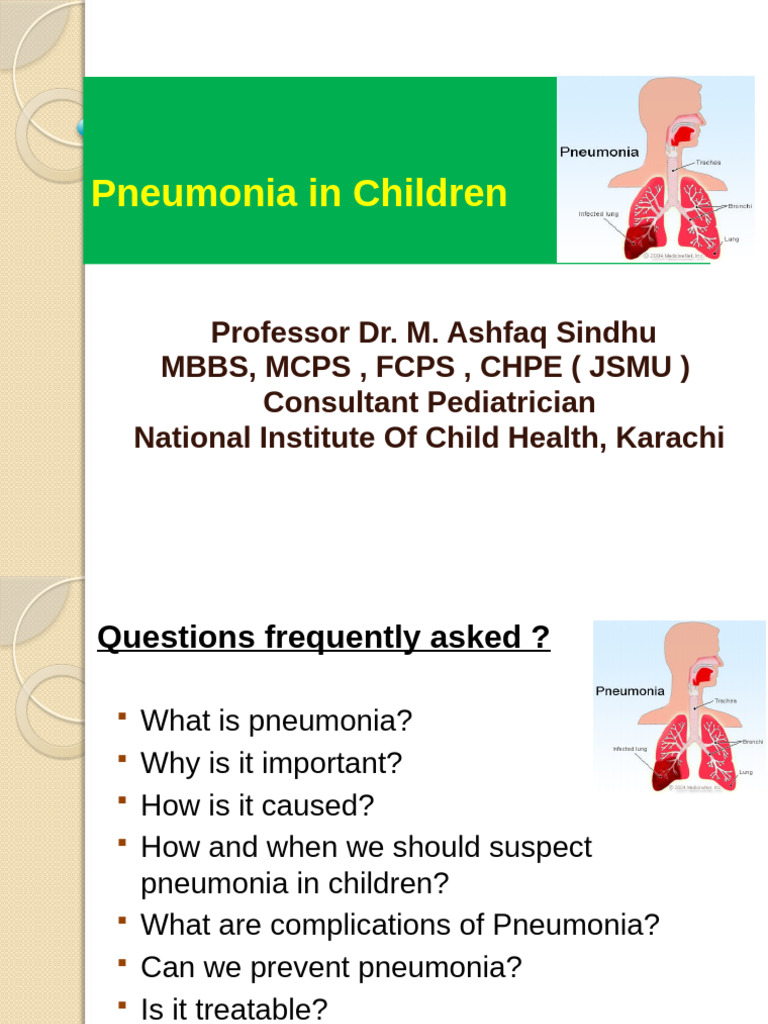 Pneumonia Peads | PDF