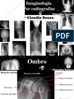 Aula 2 - Imaginologia por radiografias. Ombro e cintura escapular. Profº Claudio Souza