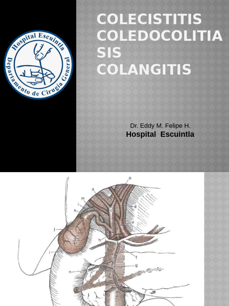4colelitiasis, Coledocolitiasis | PDF