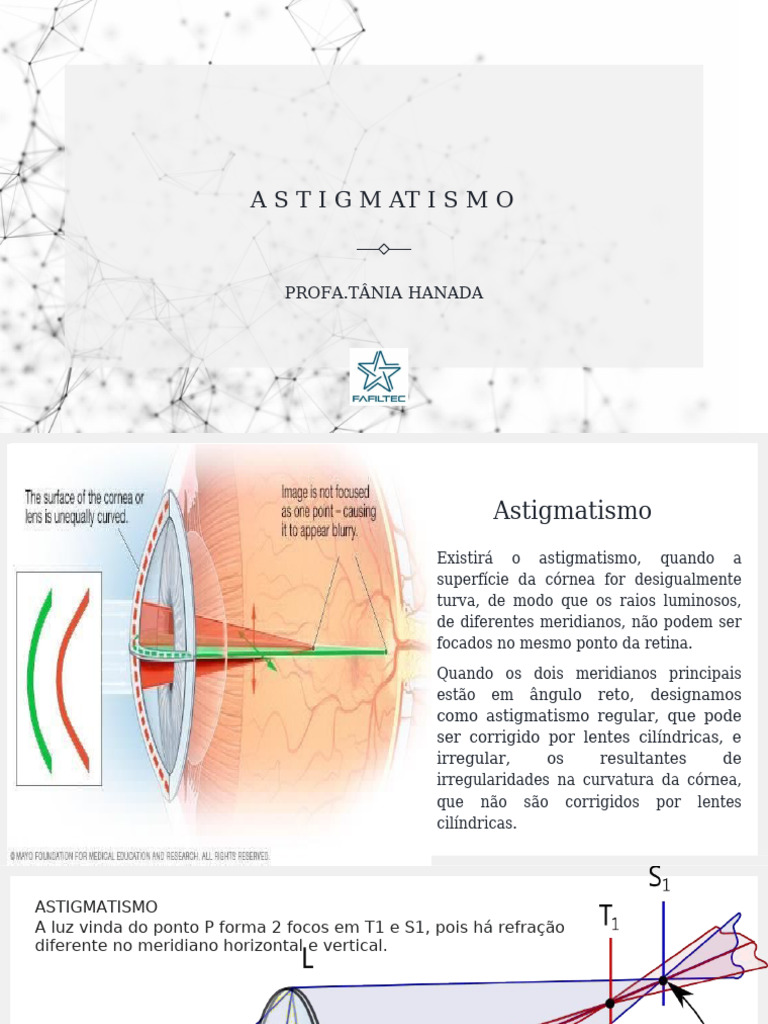 Astigmatism o | PDF