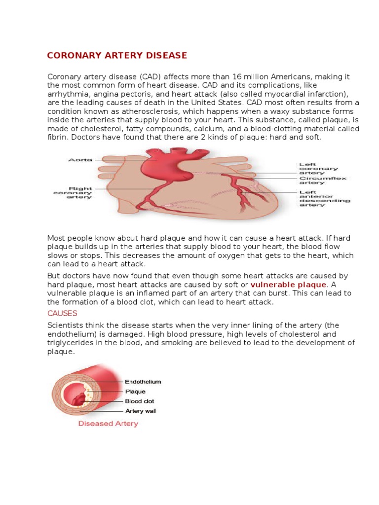 Coronary Artery Disease | PDF | Percutaneous Coronary Intervention ...