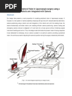 Enabling Peripheral Vision in Laparoscopic Surgery Using a Robotic Arm Integrated With Camera