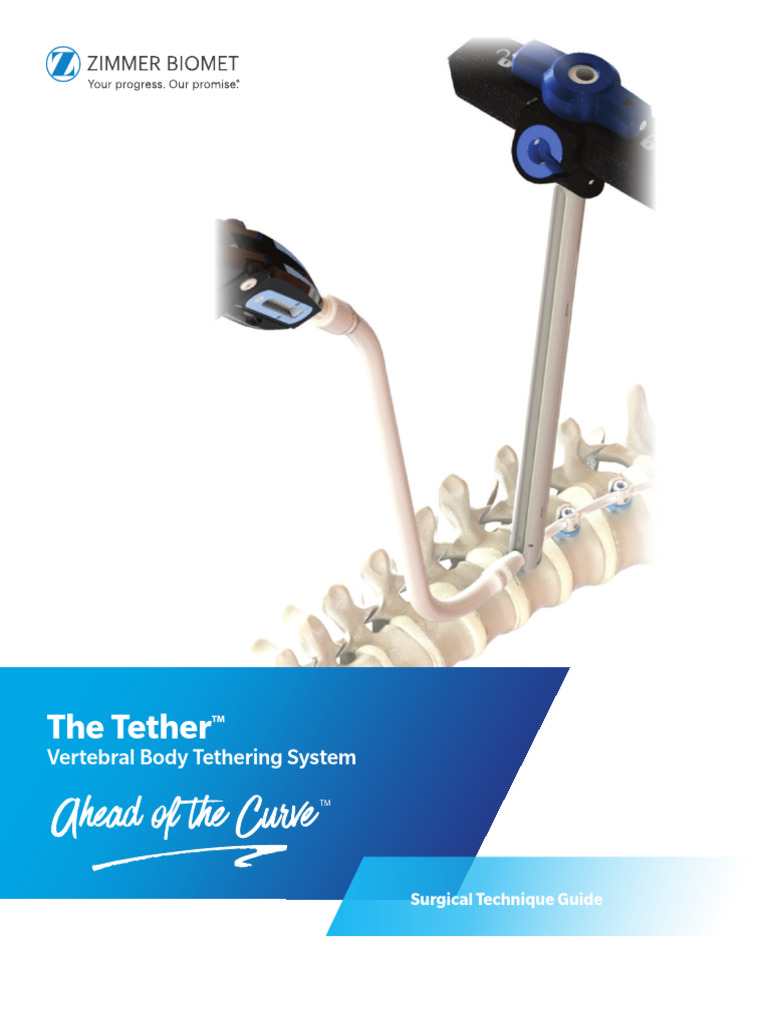 The Tether Surgical Technique | PDF