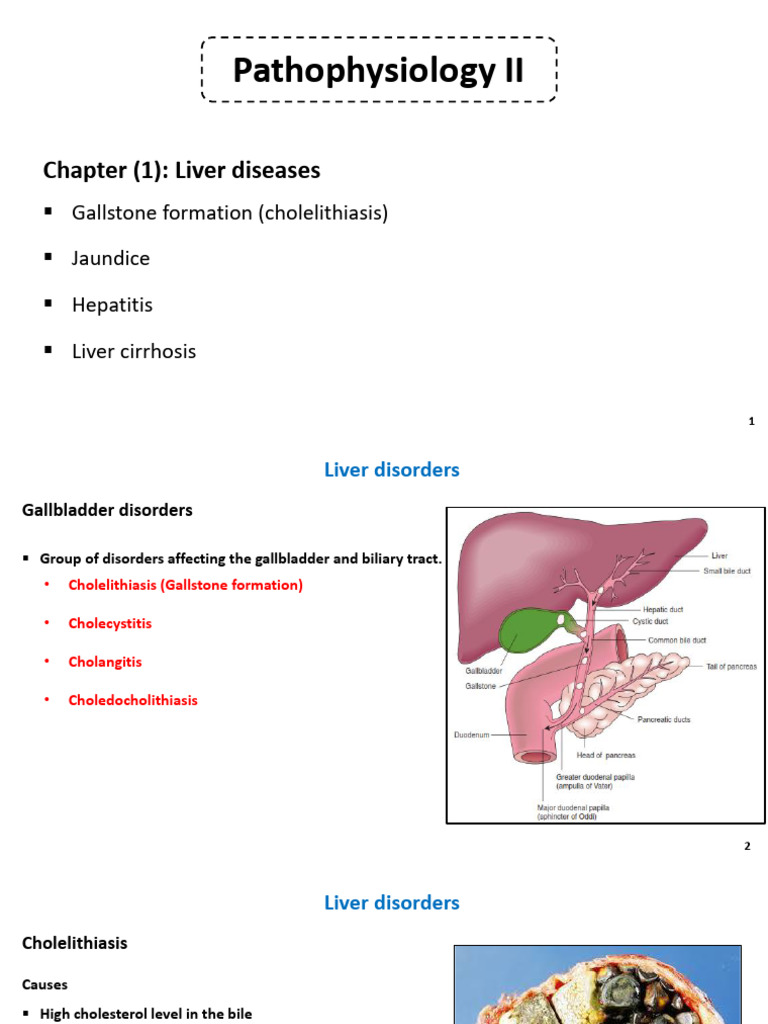 LIVER DISEASE THE BASICS visual data 2