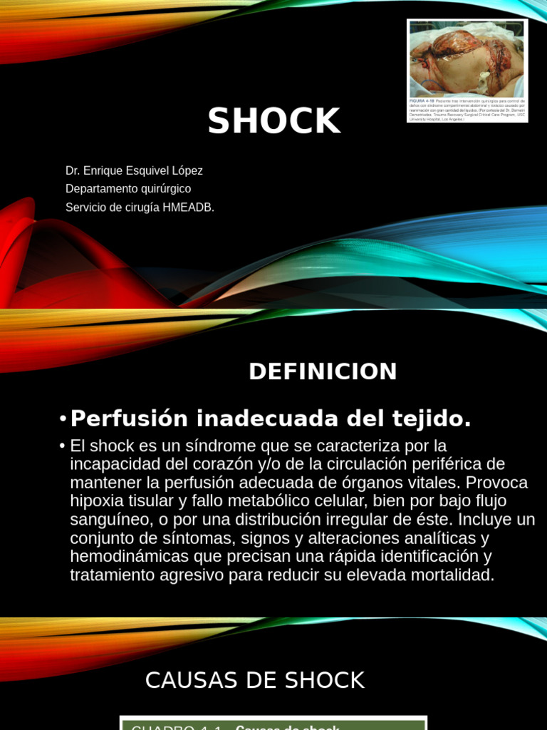 Shock | PDF