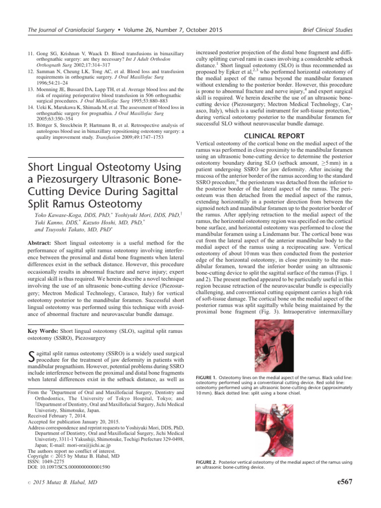 Short Lingual Osteotomy Using A Piezosurgery Ultrasonic BoneCutting ...