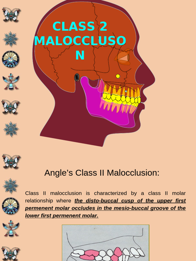 Class II | PDF