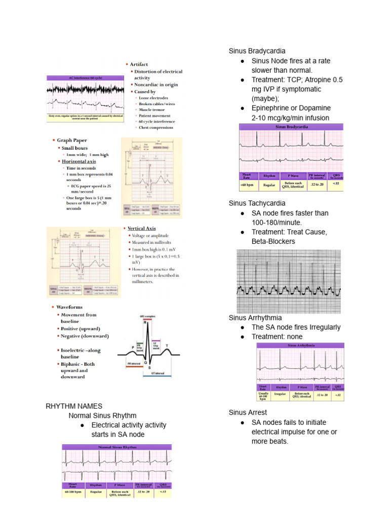 Reviewer Ecg | PDF