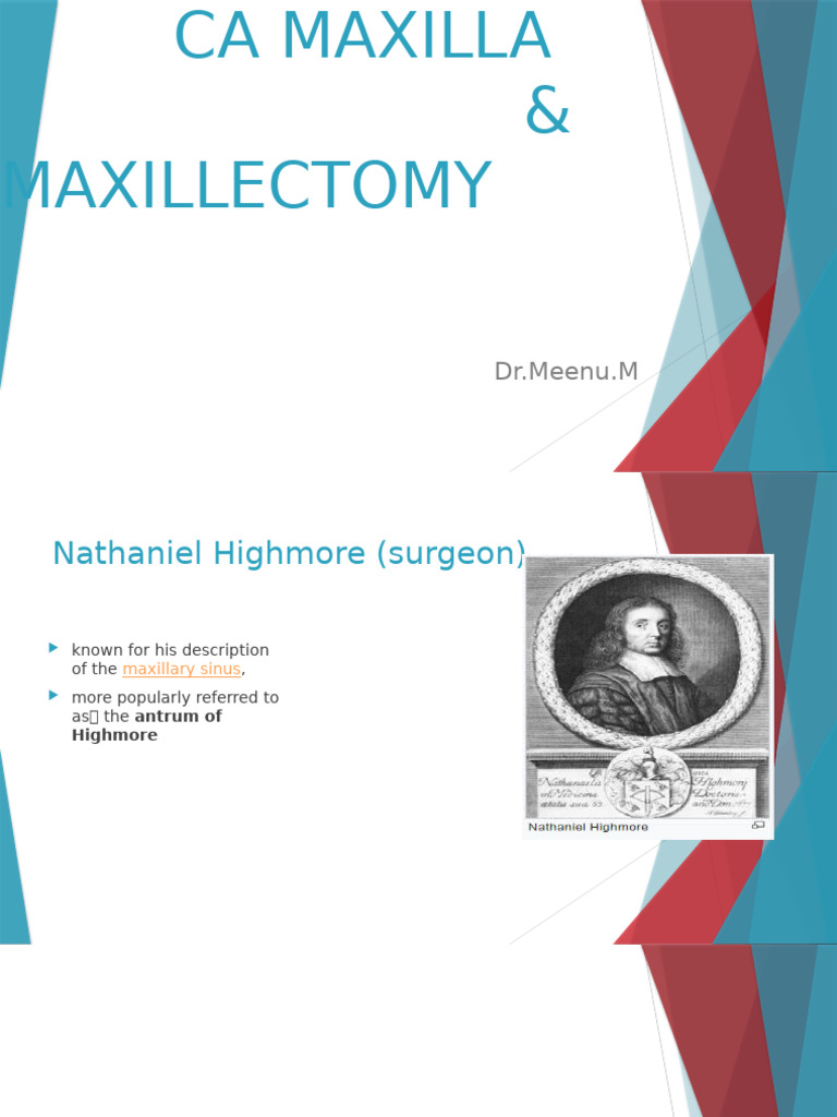 CA Maxillary Sinus | PDF