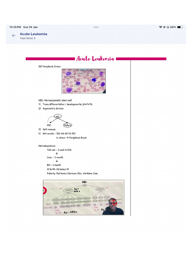 Acute Leukemia | PDF