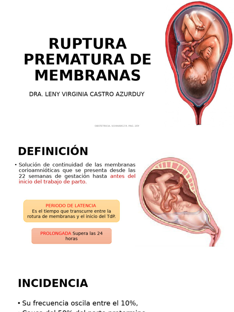Ruptura Prematura de Membranas | PDF