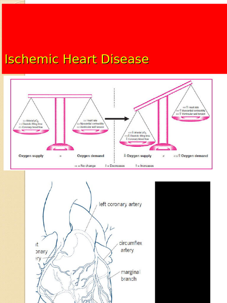 Overview of Ischemic Heart Disease | PDF | Coronary Artery Disease ...