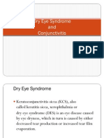 Dry Eye Syndrome