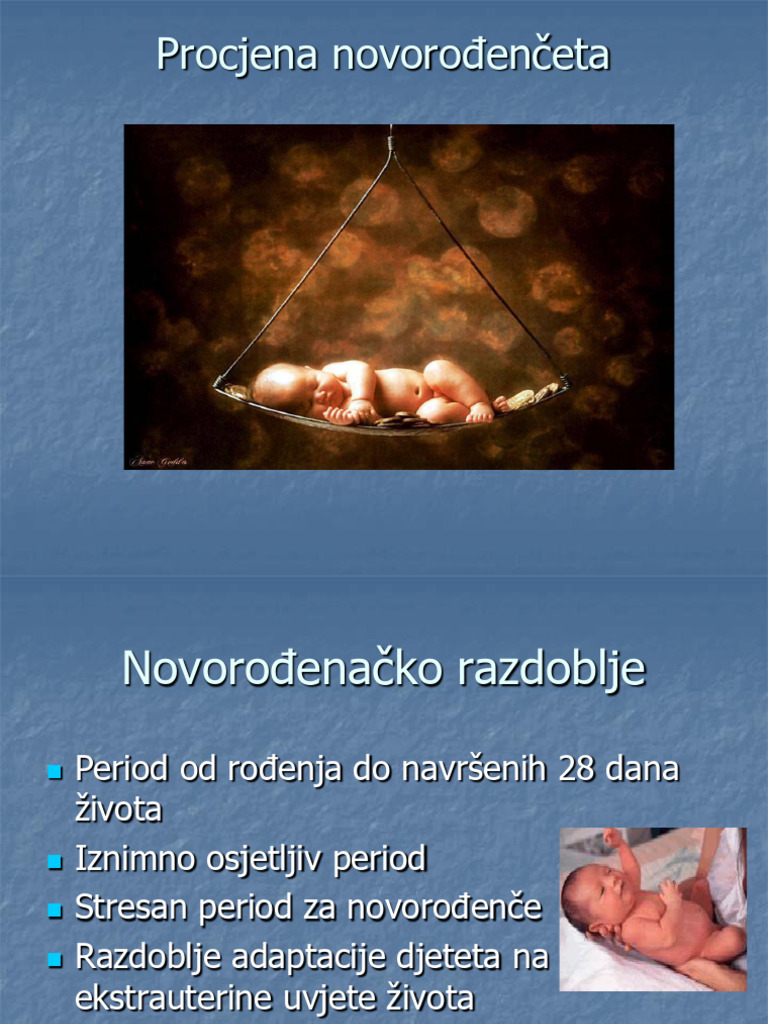 Procjena Novorođenčeta | PDF