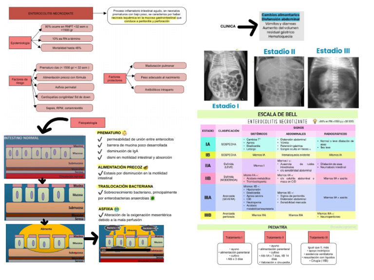 Enterocolitis Resumen | PDF