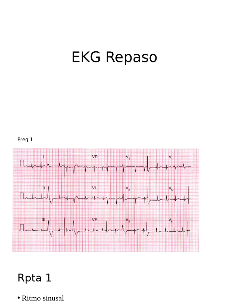 EKG Repaso | PDF