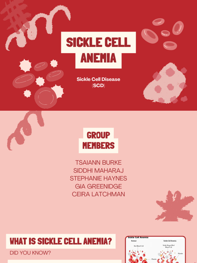 Understanding Sickle Cell Anemia | PDF | Anemia | Blood