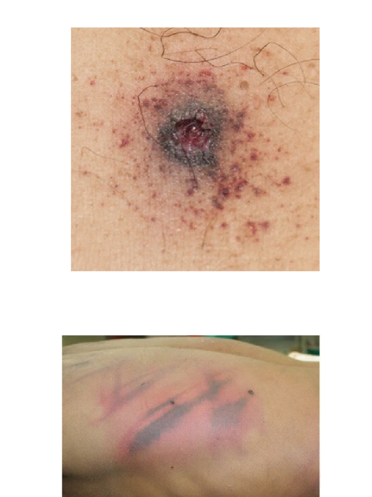 Injuries | PDF
