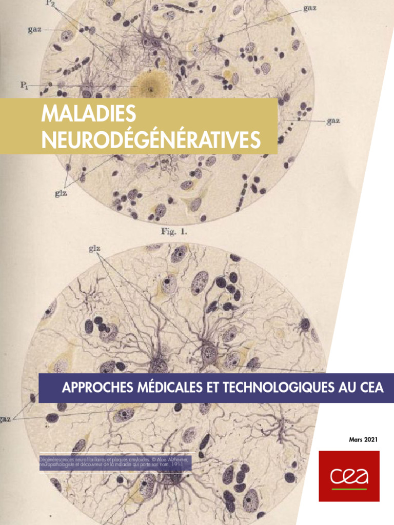 Lutte du CEA contre les maladies neurodégénératives | PDF | Maladie d ...