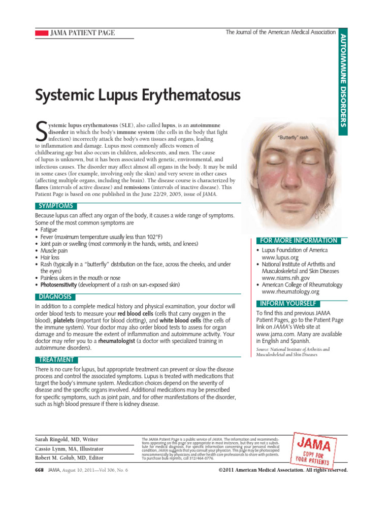 Systemic Lupus Erythematosus Pdf