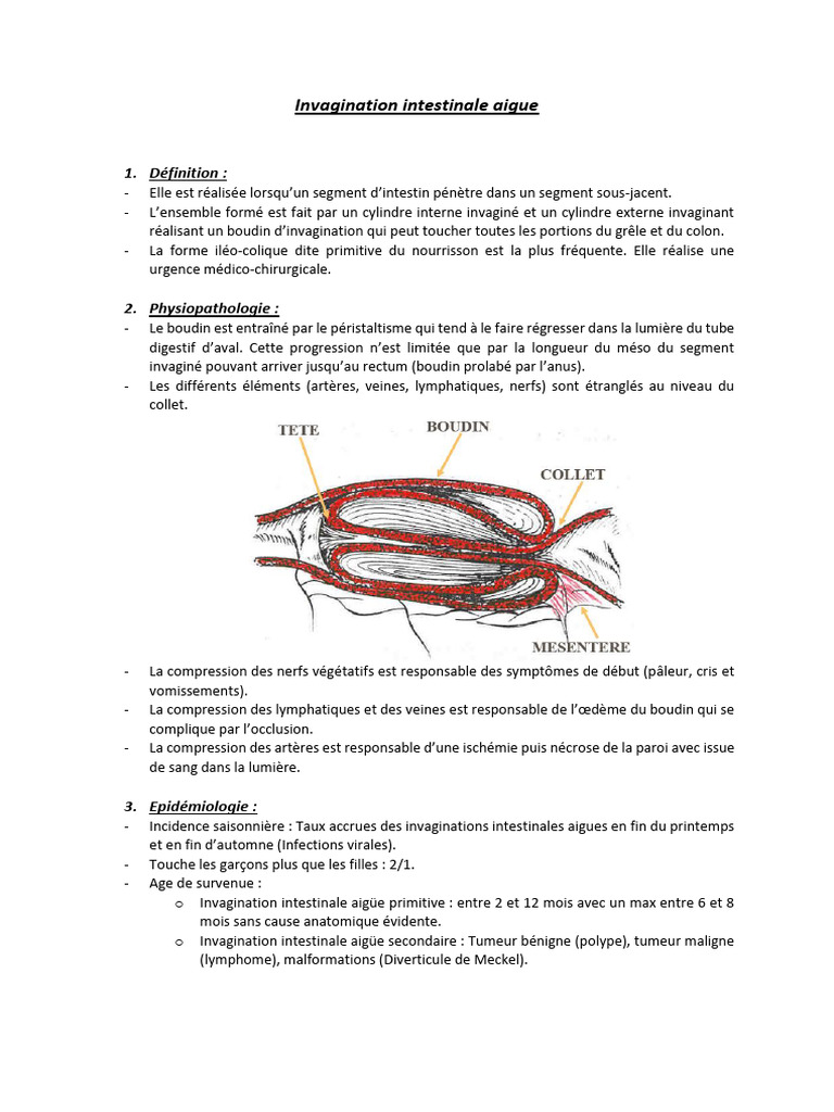Invagination Intestinale Aiguë : Symptômes, Traitement, Définition – HASXZS