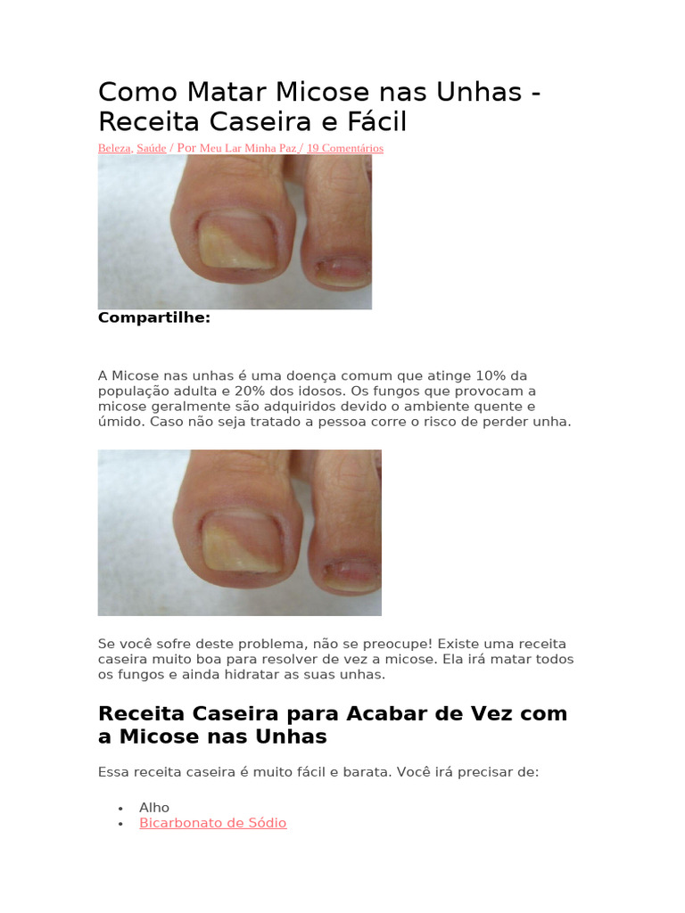 Receita Caseira para Micose nas Unhas | PDF