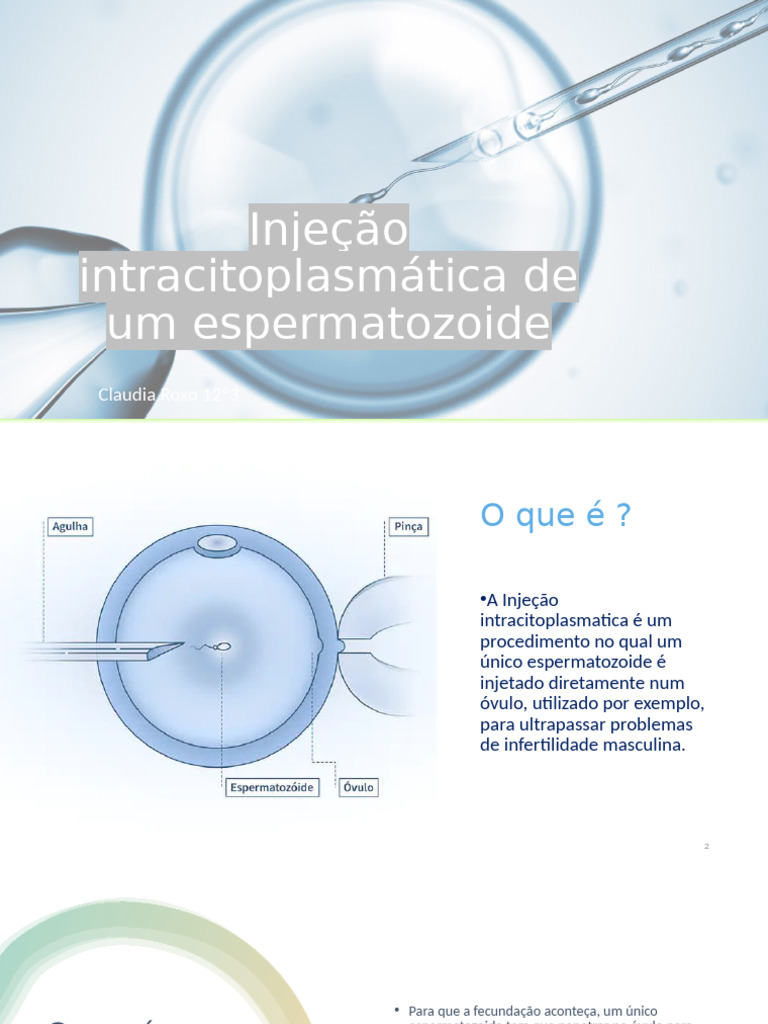 Injeção Intracitoplasmática de Um Espermatozoide | PDF